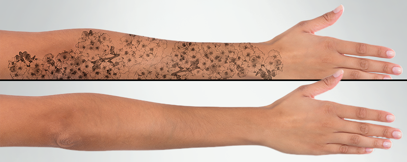 Dermatologie am Sittardsberg